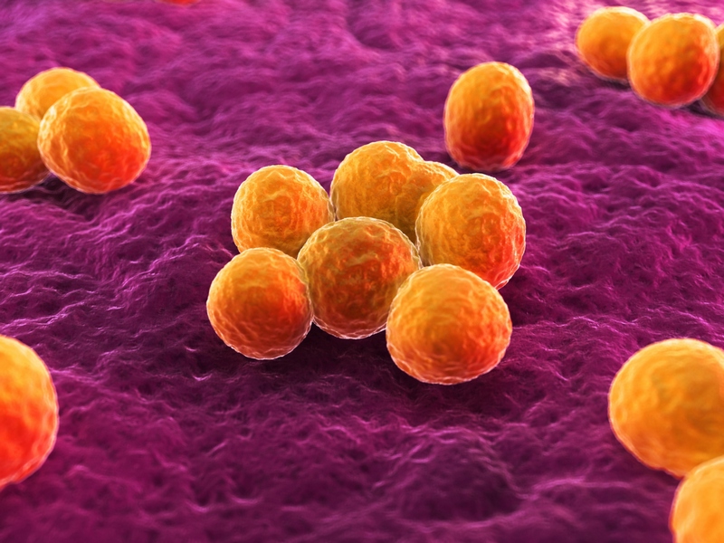 What reputable medical websites have pictures of MRSA infections?